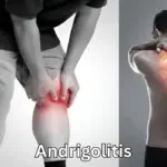 andrigolitis