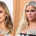 erin moriarty before and after surgeries