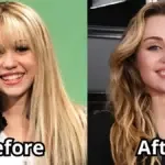 miley cyrus teeth before and after